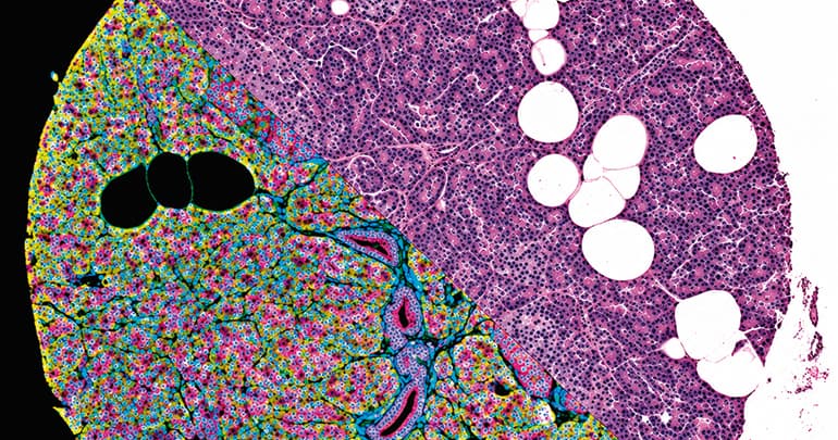 Un nuevo atlas celular del páncreas humano revela cómo se adapta a las enfermedades